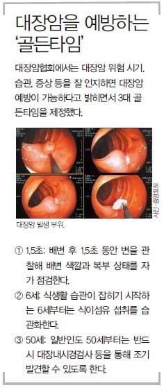 [건강특집] 선진국형 癌, 대장암이 몰려온다